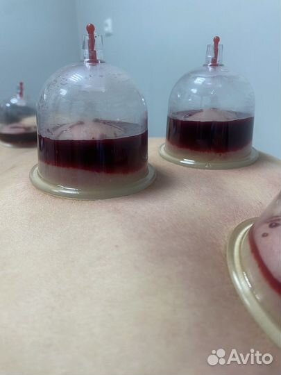 Лечебный массаж