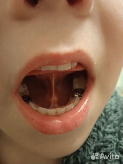 Логопед дефектолог, логомассаж