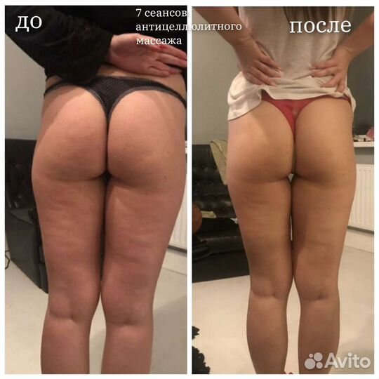 Антицеллюлитный массаж, классический, массаж лица