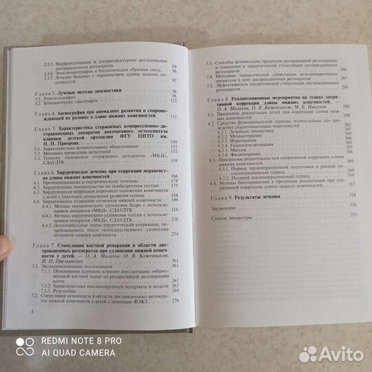 Неравенство длины нижних конечн. у детей, Малахов