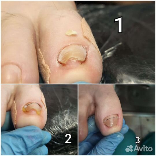 Услуги подолога