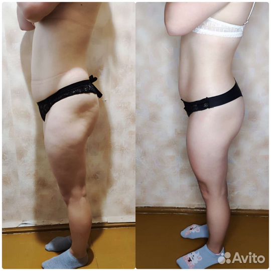 Антицеллюлитный (женский) массаж