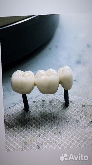 Зубной техник керамист