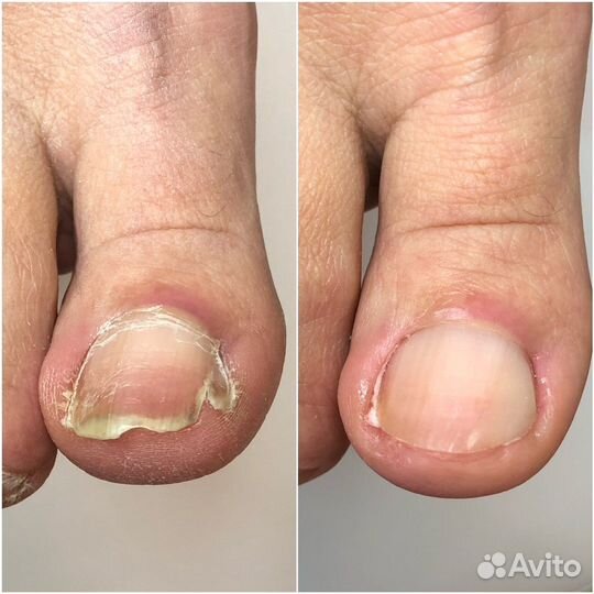 Педикюр подолог центр