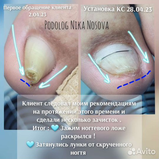 Услуги подолога