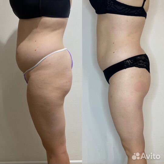 Массаж тела