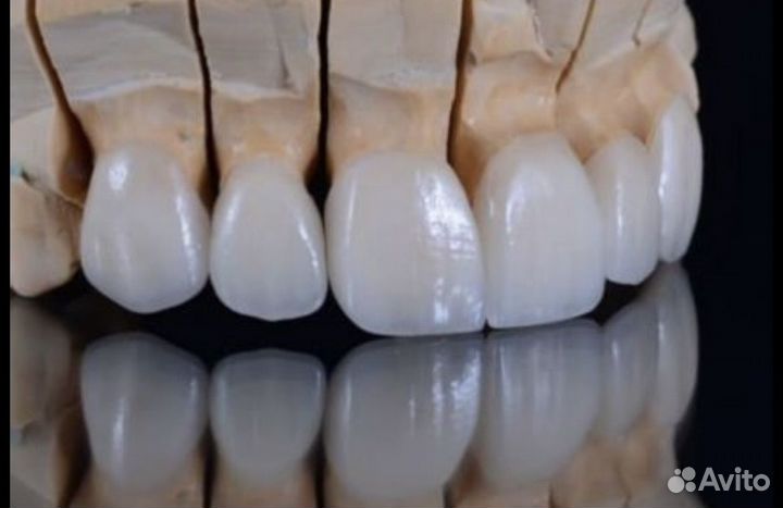 Услуги зубного техника