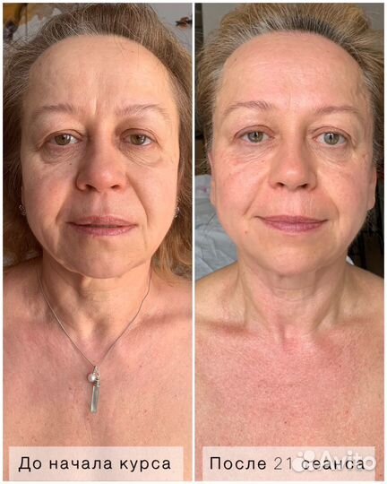 Массаж лица и тела