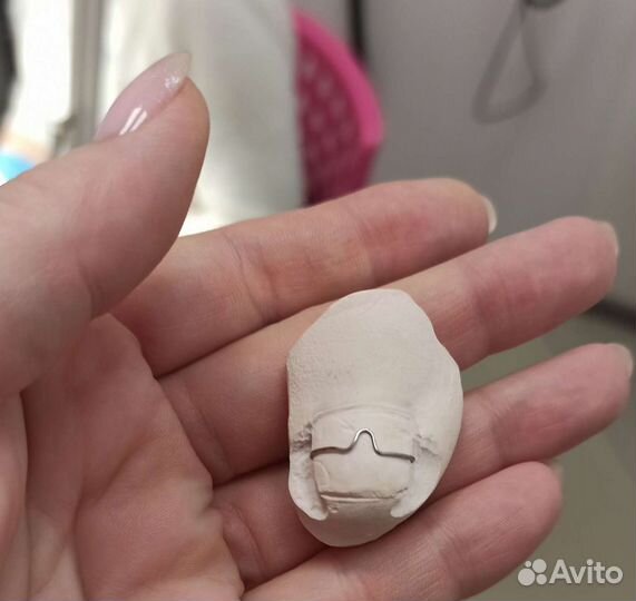 Подолог.Москва.Медицинский педикюр.Вросший ноготь