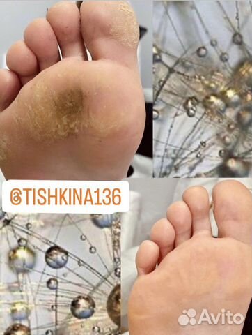 Медицинский и эстетический педикюр и маникюр