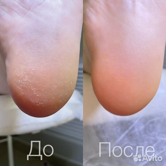 Маникюр гель лак, наращивание ногтей педикюр