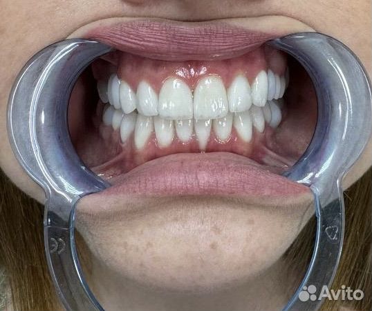 Емах/Диокцид циркония