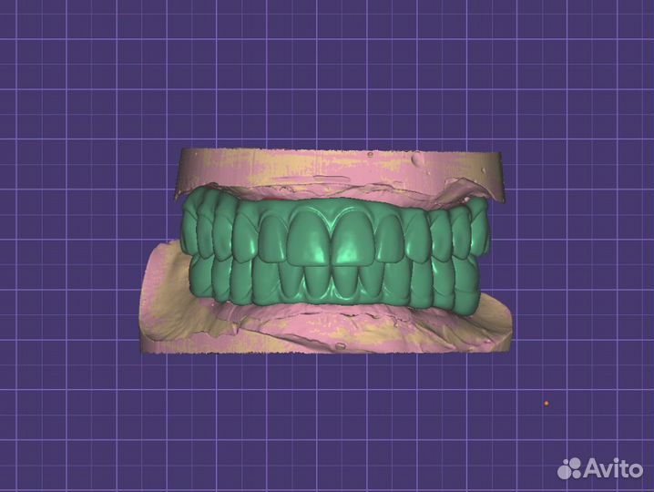 Обучение ExoCad Cad/Cam. Курсы на выбор