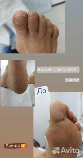 Педикюр с покрытием лаком