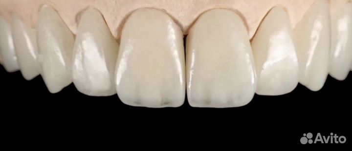 Услуги зубного техника