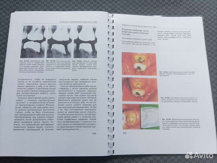 Основы препарирования зубов Шиллинбург