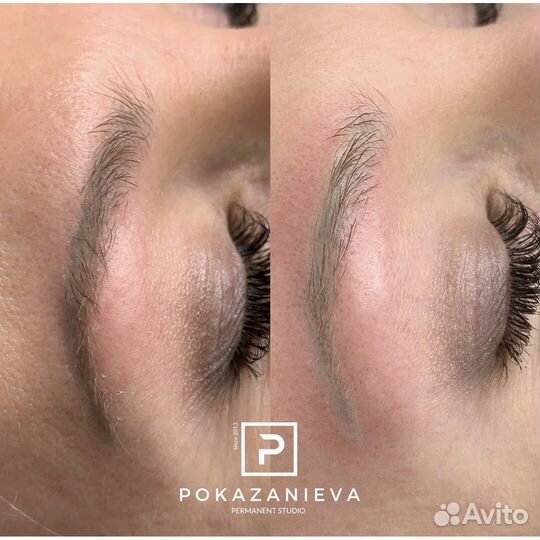 Удаление тату, татуажа бровей губ глаз