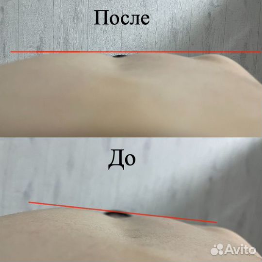 Профессиональный массаж. Устранение болей