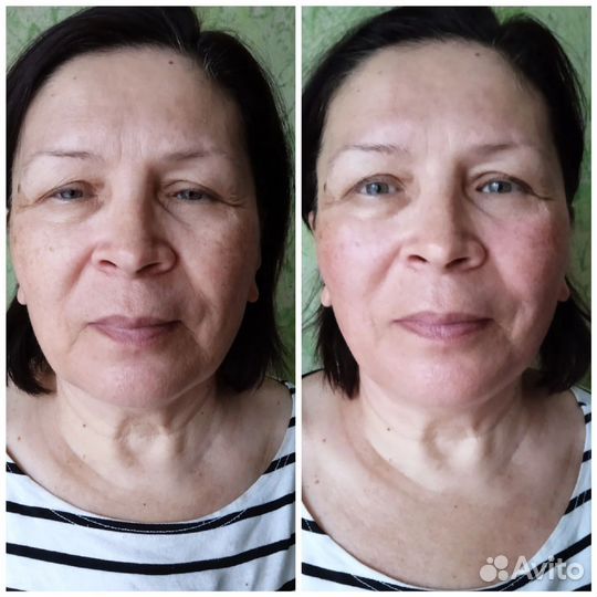 Массаж лица. Массаж для женщин