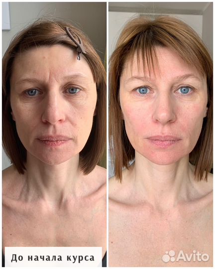 Массаж лица и тела