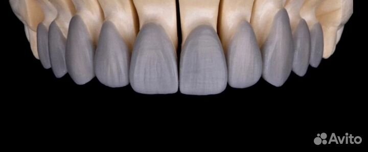 Услуги зубного техника