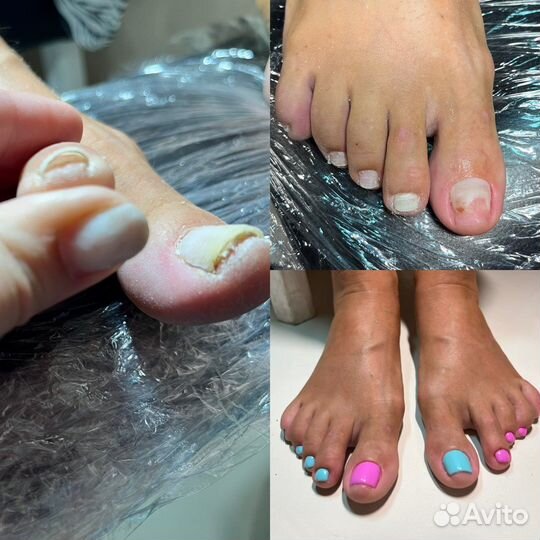 Маникюр и Педикюр