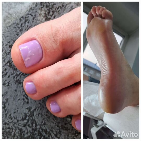 Смарт педикюр