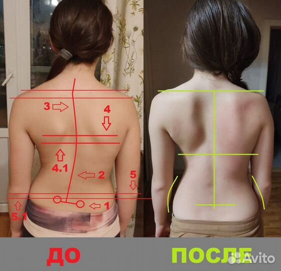 Мануальный терапевт костоправ