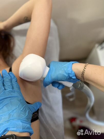 Лазерная эпиляция: ягодицы