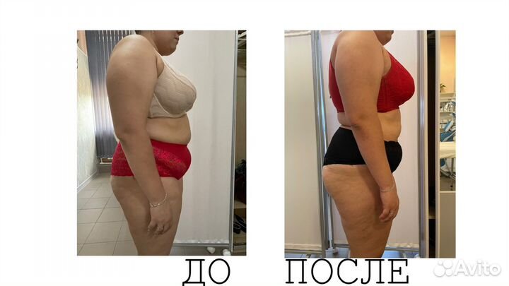 Криолиполиз/Массаж/Косметолог/Миостимуляция