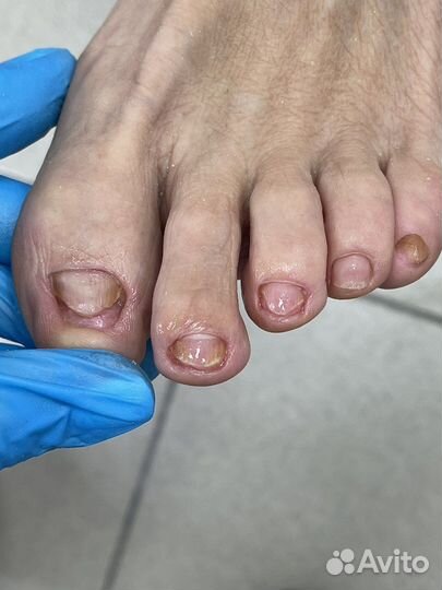 Педикюр серпухов