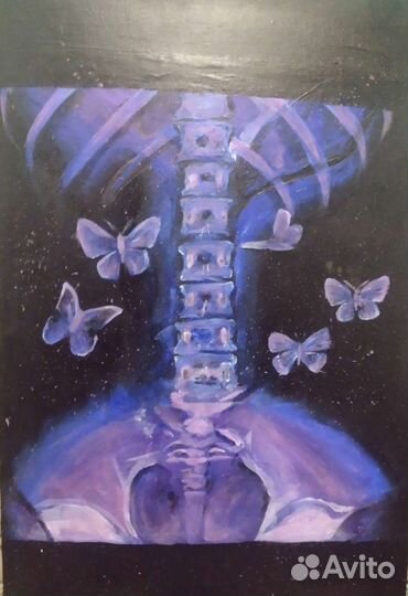 Картина 40 на 60 Бабочки в животе, акрил