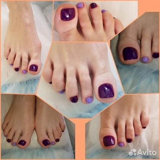 Педикюр Депиляция Лазер