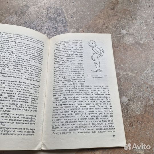 Ортопедия детей первого года жизни. Мирзоева. 1983