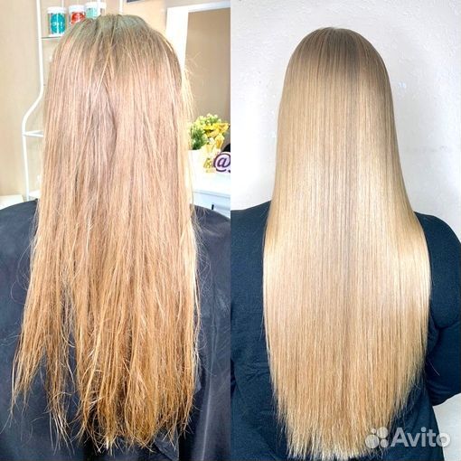 Восстановление, лечение,интенсивная терапи