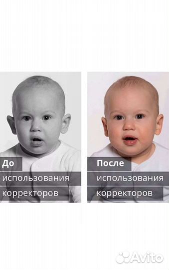 Корректор для ушей арилис