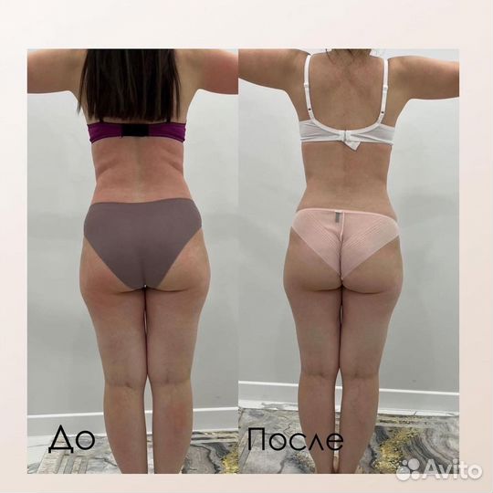 Аппаратный массаж