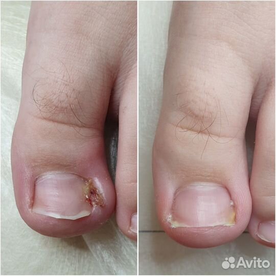 Подолог Сочи с выездом на дом