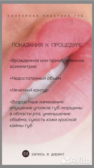 Контурная пластика губ