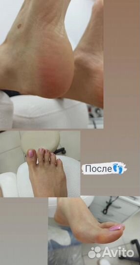 Педикюр с покрытием лаком