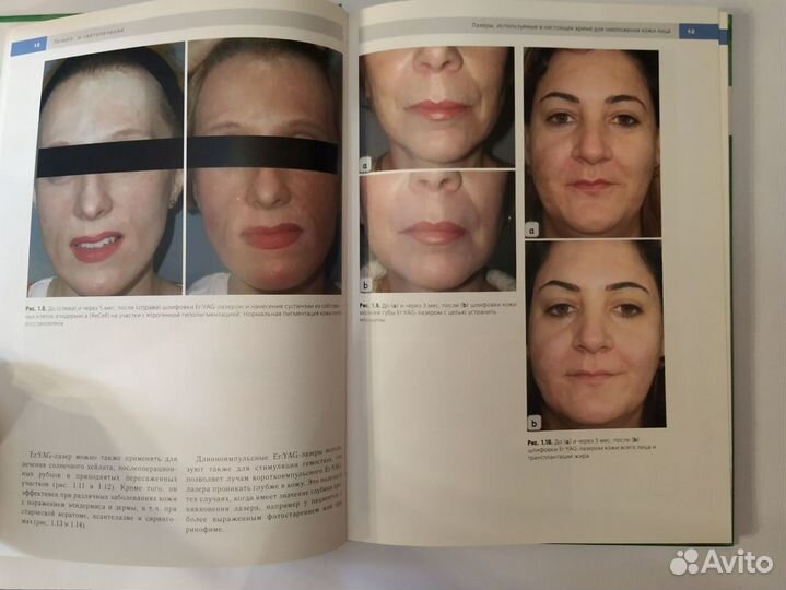 Книга Омоложение лица для косметологов