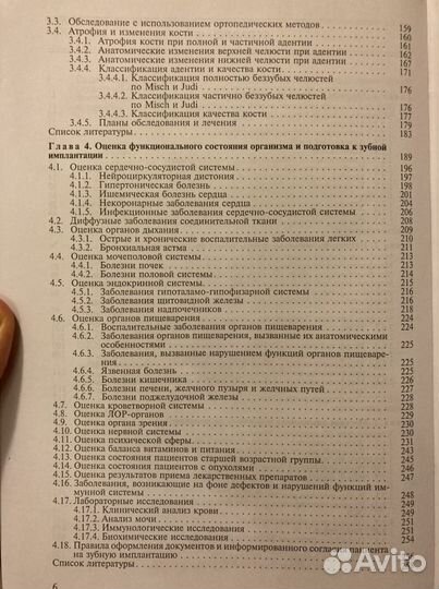 Имплантация зубов