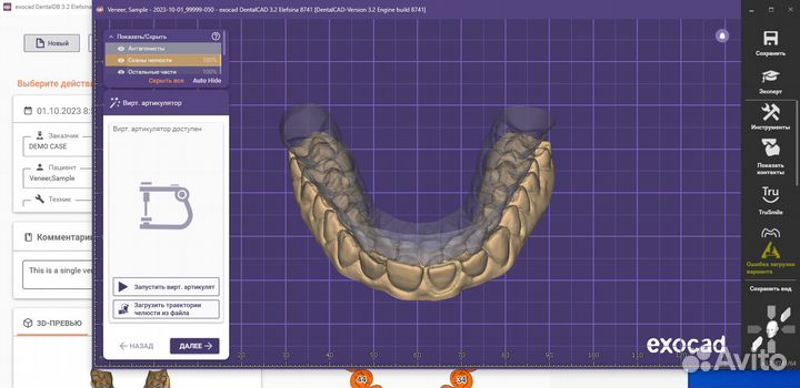 Exocad 3.2 Elefsina 8820 (24.02.2024)