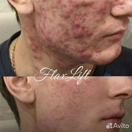 Услуги косметолога