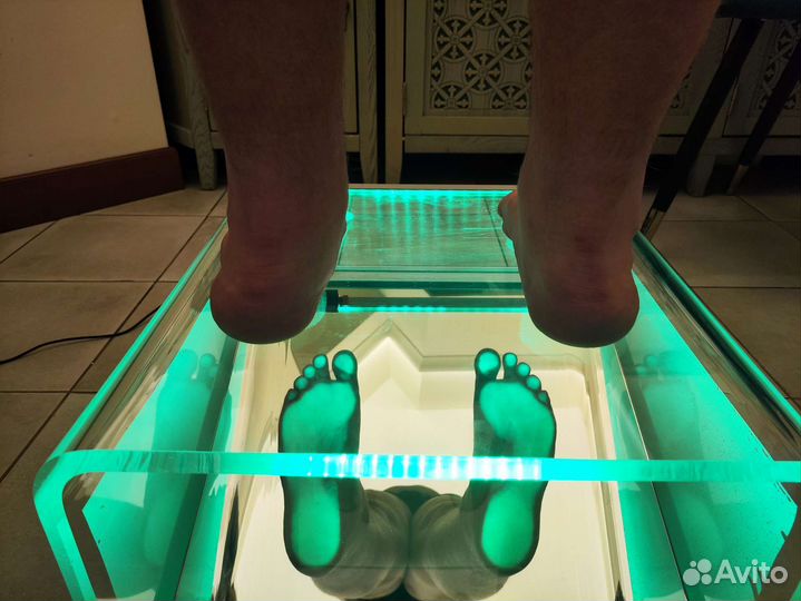 Изготовление индивидуальных ортопедических стелек