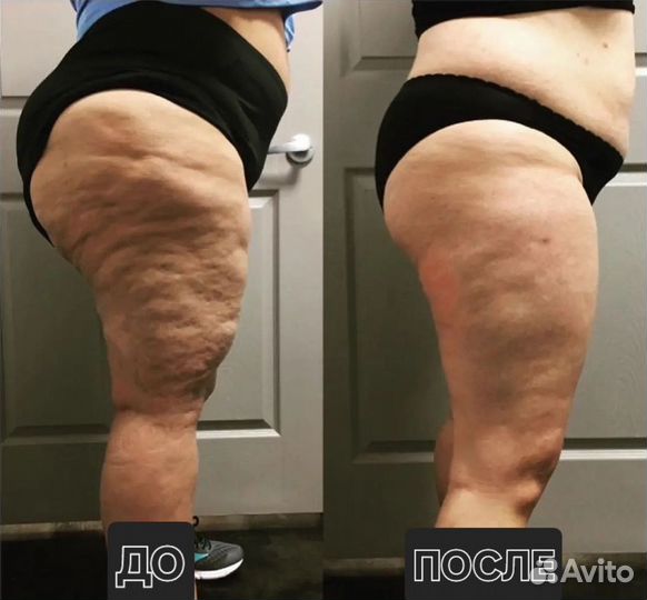 Массаж коррекция фигуры похудение