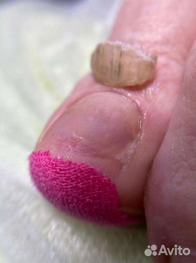 Педикюр подолог