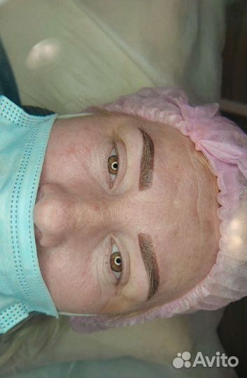 Перманентный макияж (татуаж) Удаление татуажа