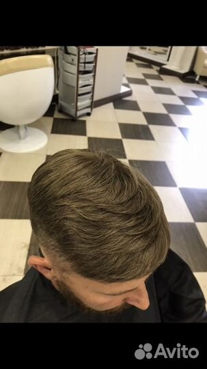 Мужская безоперационная система замещения волос