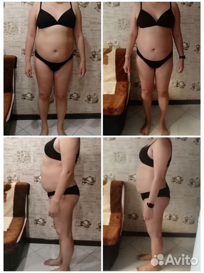 Антицеллюлитный массаж, массаж лица, прессотерапия